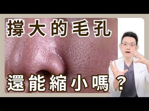 左臉長白毛|如何化解左臉長白毛的厄運？